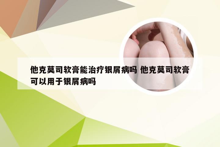 他克莫司软膏能治疗银屑病吗 他克莫司软膏可以用于银屑病吗