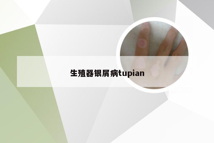 生殖器银屑病tupian