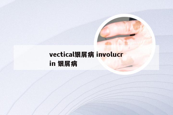 vectical银屑病 involucrin 银屑病