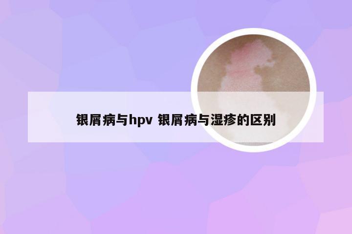 银屑病与hpv 银屑病与湿疹的区别