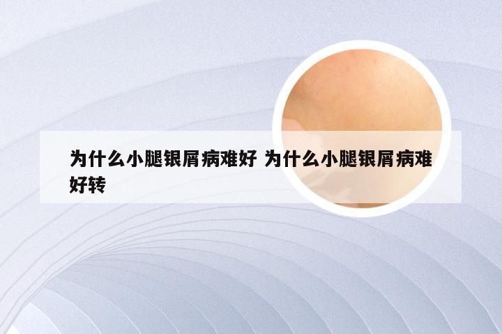 为什么小腿银屑病难好 为什么小腿银屑病难好转