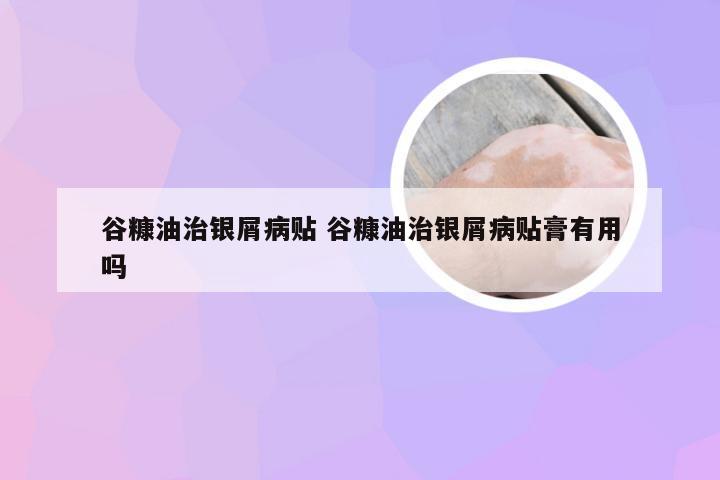 谷糠油治银屑病贴 谷糠油治银屑病贴膏有用吗