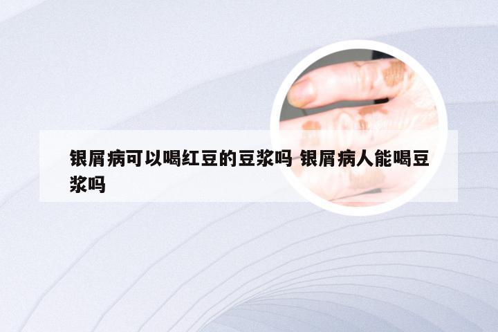 银屑病可以喝红豆的豆浆吗 银屑病人能喝豆浆吗