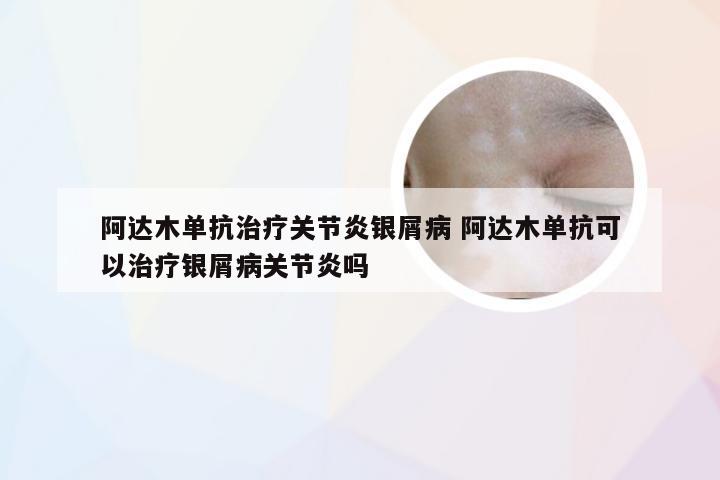 阿达木单抗治疗关节炎银屑病 阿达木单抗可以治疗银屑病关节炎吗