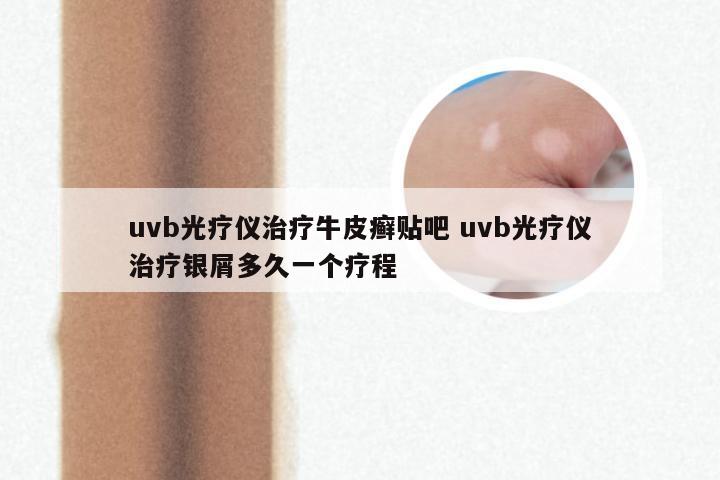 uvb光疗仪治疗牛皮癣贴吧 uvb光疗仪治疗银屑多久一个疗程