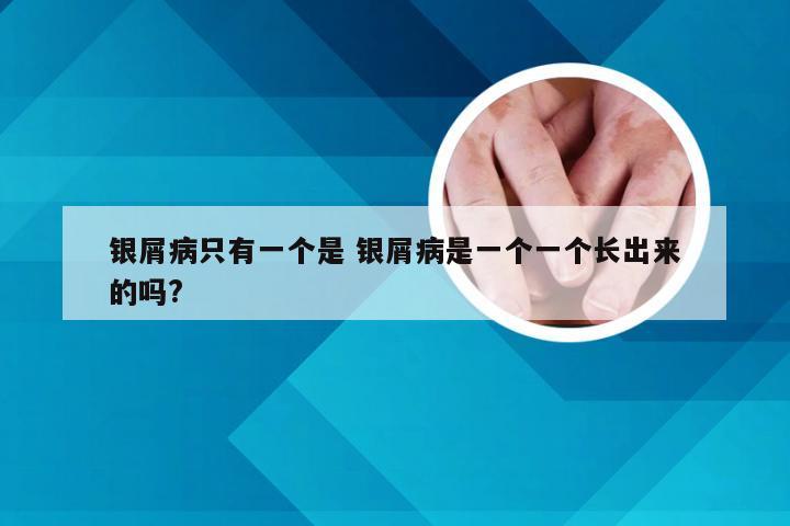 银屑病只有一个是 银屑病是一个一个长出来的吗?