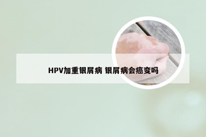 HPV加重银屑病 银屑病会癌变吗