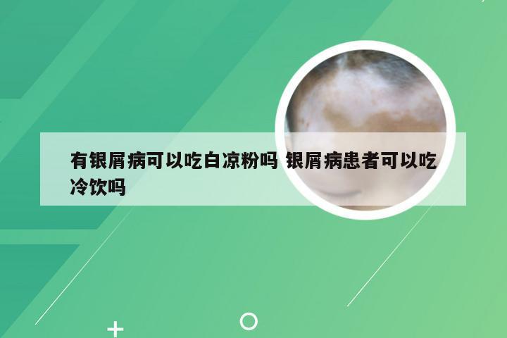 有银屑病可以吃白凉粉吗 银屑病患者可以吃冷饮吗