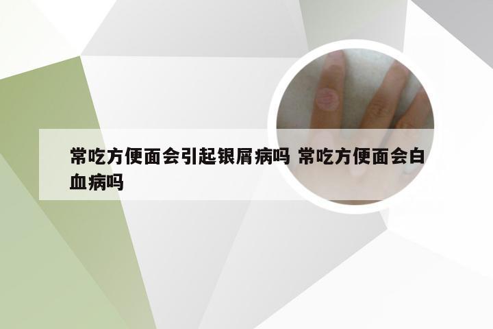 常吃方便面会引起银屑病吗 常吃方便面会白血病吗