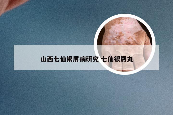 山西七仙银屑病研究 七仙银屑丸