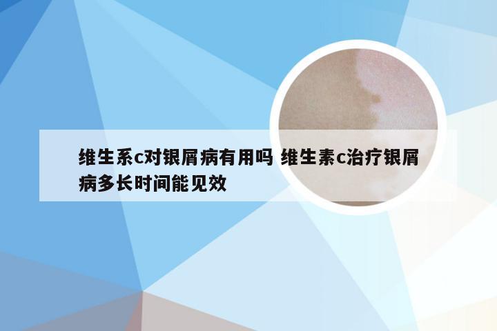 维生系c对银屑病有用吗 维生素c治疗银屑病多长时间能见效