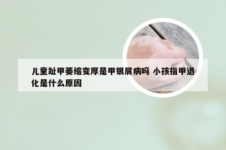 儿童趾甲萎缩变厚是甲银屑病吗 小孩指甲退化是什么原因