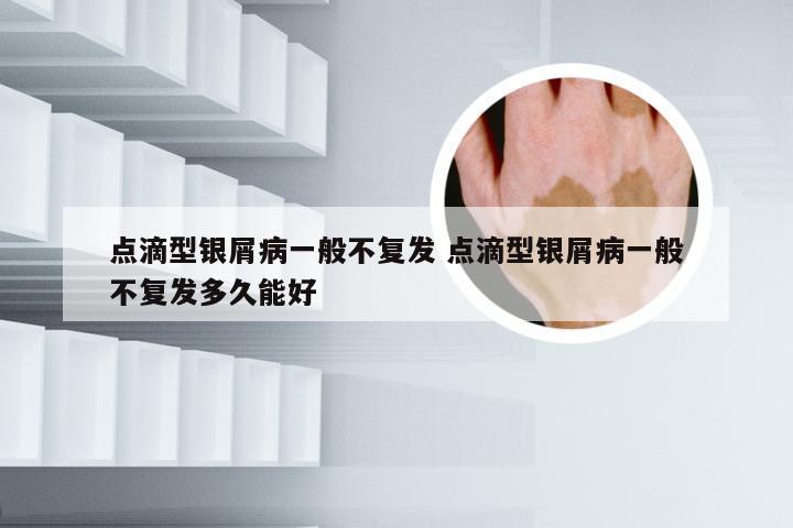 点滴型银屑病一般不复发 点滴型银屑病一般不复发多久能好