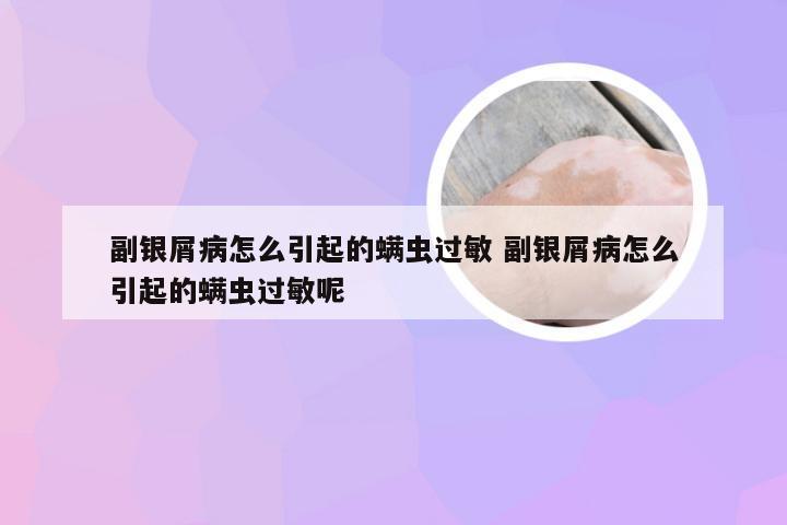 副银屑病怎么引起的螨虫过敏 副银屑病怎么引起的螨虫过敏呢