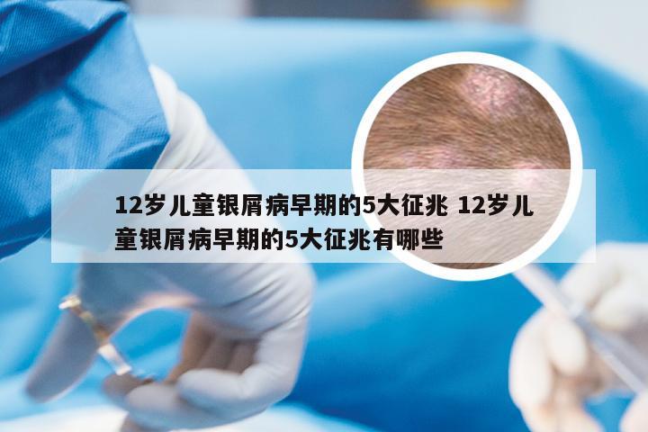 12岁儿童银屑病早期的5大征兆 12岁儿童银屑病早期的5大征兆有哪些