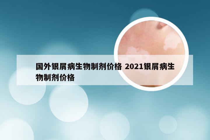 国外银屑病生物制剂价格 2021银屑病生物制剂价格