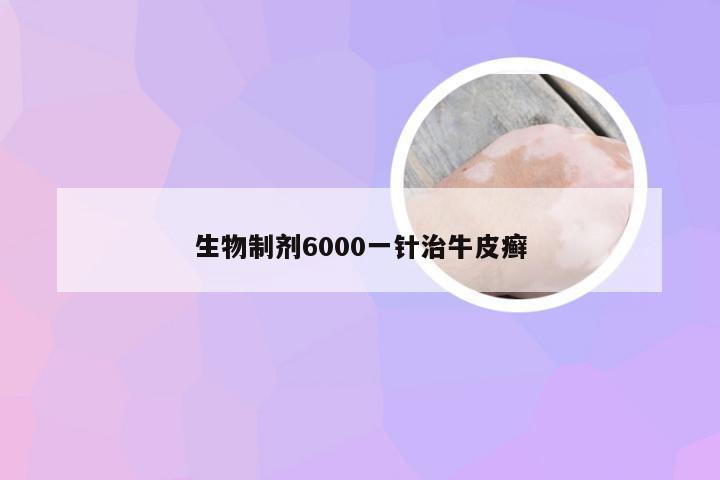 生物制剂6000一针治牛皮癣