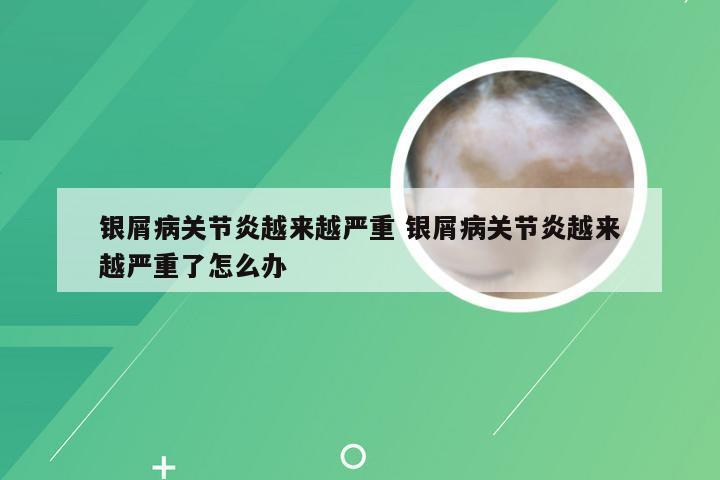 银屑病关节炎越来越严重 银屑病关节炎越来越严重了怎么办