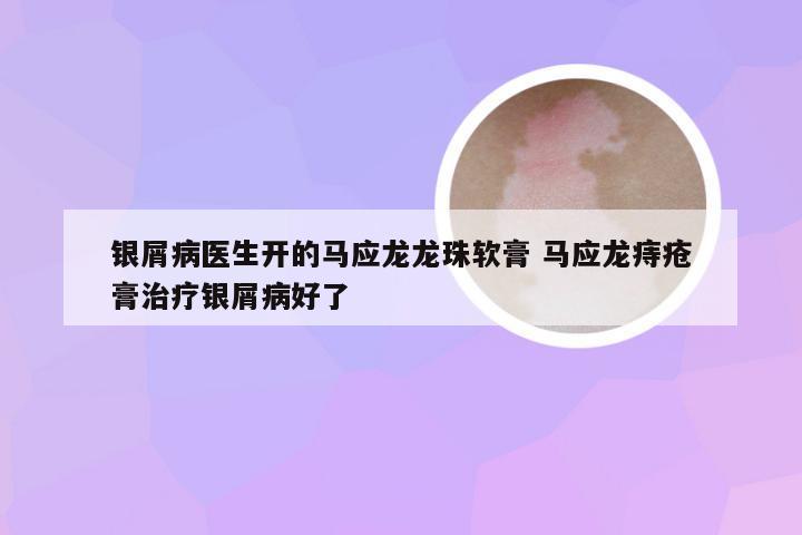 银屑病医生开的马应龙龙珠软膏 马应龙痔疮膏治疗银屑病好了