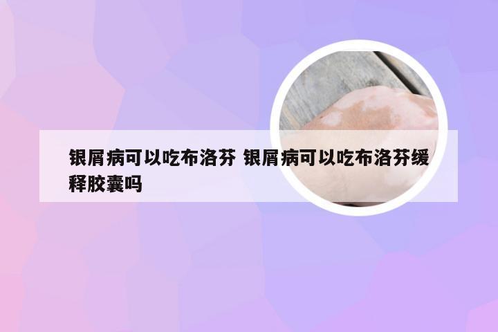 银屑病可以吃布洛芬 银屑病可以吃布洛芬缓释胶囊吗