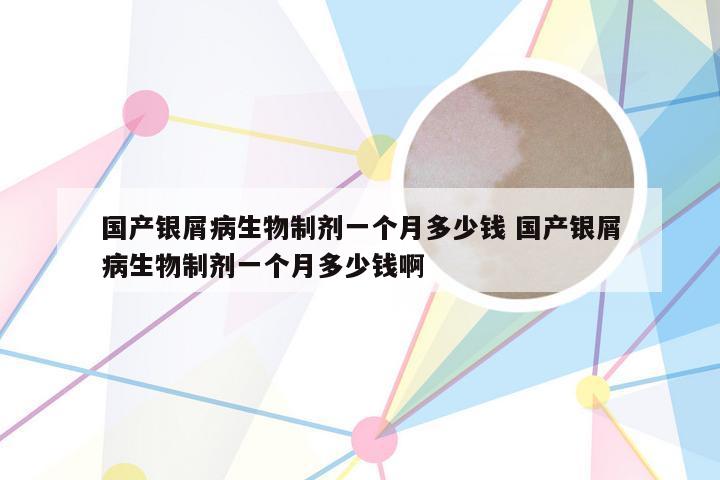 国产银屑病生物制剂一个月多少钱 国产银屑病生物制剂一个月多少钱啊