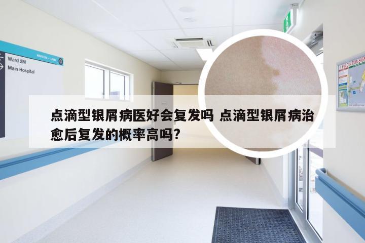 点滴型银屑病医好会复发吗 点滴型银屑病治愈后复发的概率高吗?