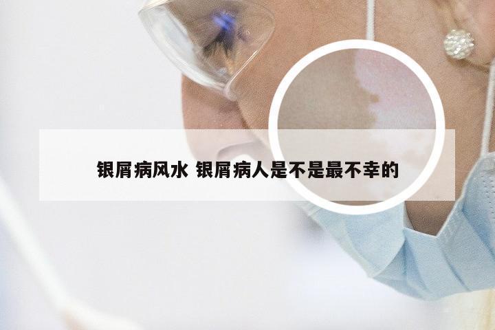 银屑病风水 银屑病人是不是最不幸的