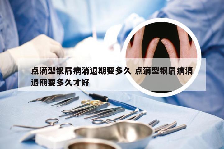 点滴型银屑病消退期要多久 点滴型银屑病消退期要多久才好