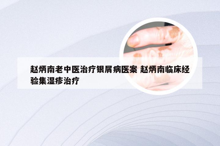 赵炳南老中医治疗银屑病医案 赵炳南临床经验集湿疹治疗