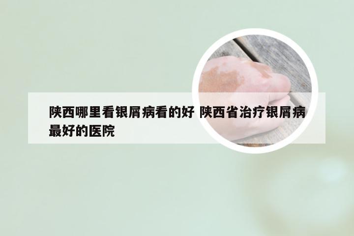 陕西哪里看银屑病看的好 陕西省治疗银屑病最好的医院