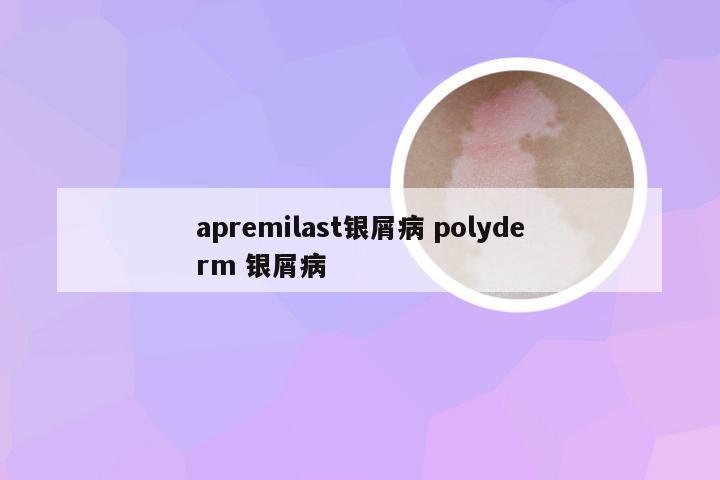 apremilast银屑病 polyderm 银屑病