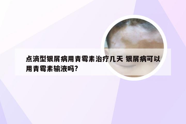 点滴型银屑病用青霉素治疗几天 银屑病可以用青霉素输液吗?