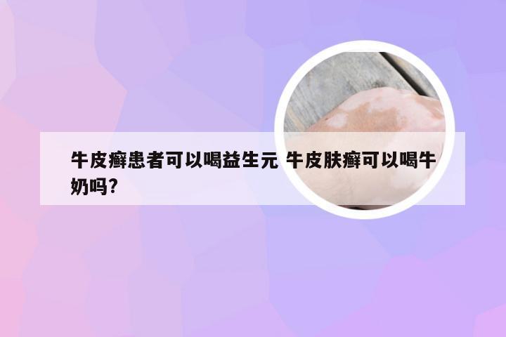 牛皮癣患者可以喝益生元 牛皮肤癣可以喝牛奶吗?