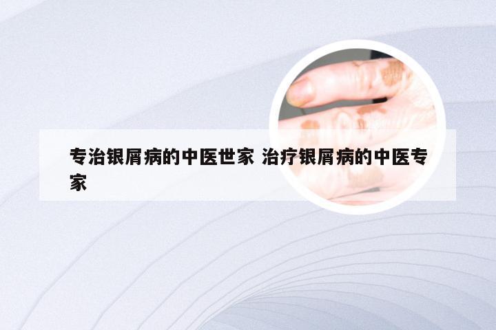 专治银屑病的中医世家 治疗银屑病的中医专家