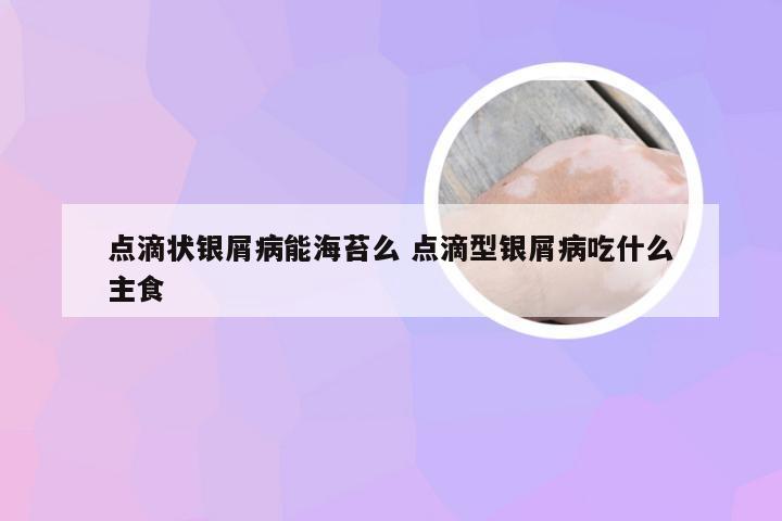 点滴状银屑病能海苔么 点滴型银屑病吃什么主食