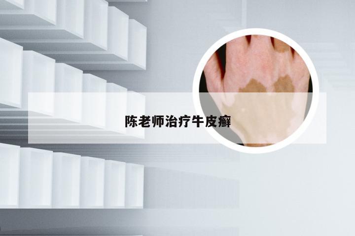 陈老师治疗牛皮癣