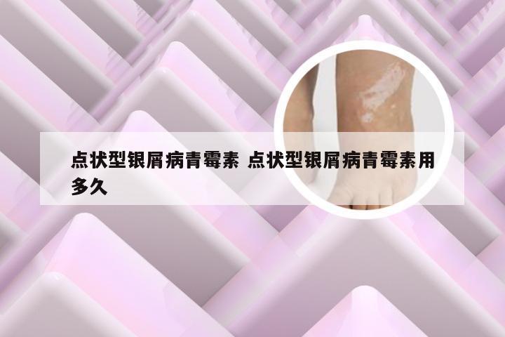 点状型银屑病青霉素 点状型银屑病青霉素用多久