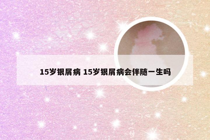 15岁银屑病 15岁银屑病会伴随一生吗