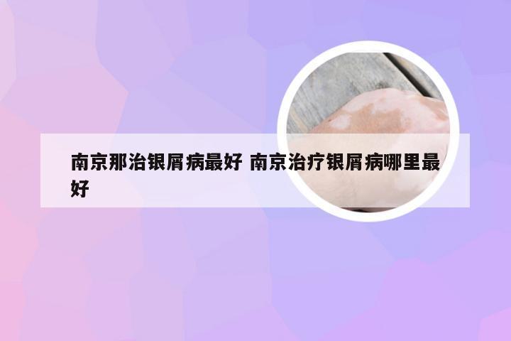 南京那治银屑病最好 南京治疗银屑病哪里最好