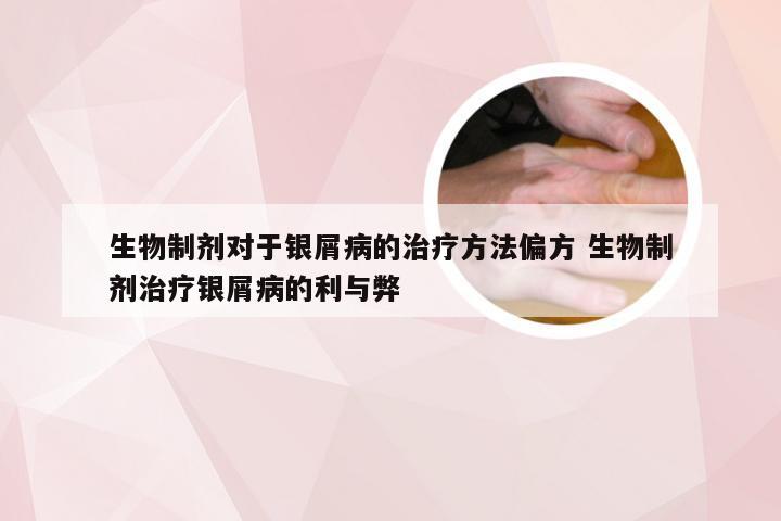 生物制剂对于银屑病的治疗方法偏方 生物制剂治疗银屑病的利与弊