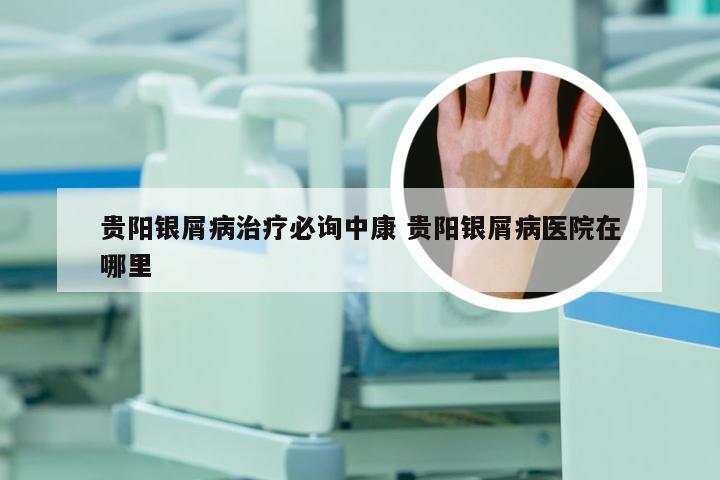 贵阳银屑病治疗必询中康 贵阳银屑病医院在哪里