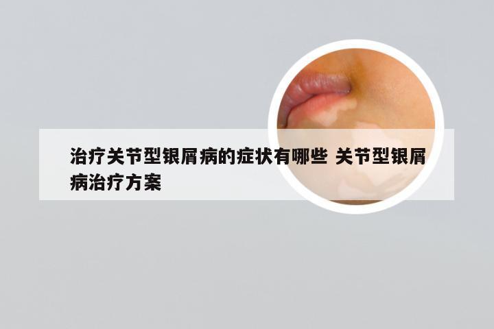 治疗关节型银屑病的症状有哪些 关节型银屑病治疗方案