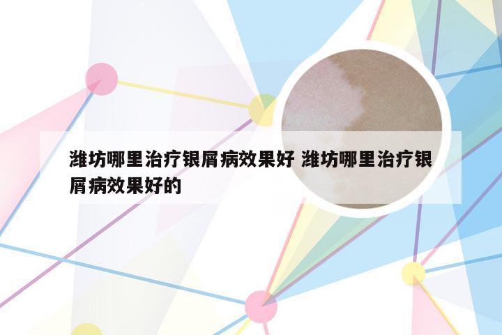 潍坊哪里治疗银屑病效果好 潍坊哪里治疗银屑病效果好的