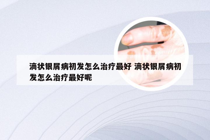 滴状银屑病初发怎么治疗最好 滴状银屑病初发怎么治疗最好呢