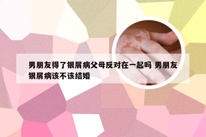 男朋友得了银屑病父母反对在一起吗 男朋友银屑病该不该结婚