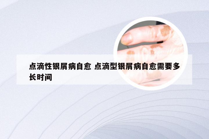 点滴性银屑病自愈 点滴型银屑病自愈需要多长时间