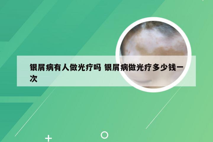 银屑病有人做光疗吗 银屑病做光疗多少钱一次