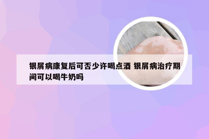 银屑病康复后可否少许喝点酒 银屑病治疗期间可以喝牛奶吗