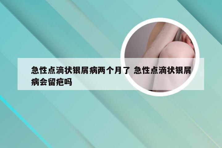 急性点滴状银屑病两个月了 急性点滴状银屑病会留疤吗