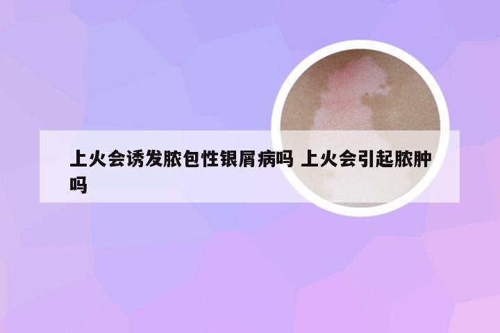 上火会诱发脓包性银屑病吗 上火会引起脓肿吗